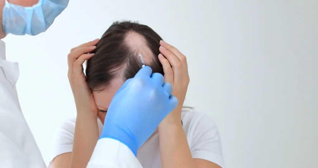 Leczenie immunomodulujące-łysienie plackowate